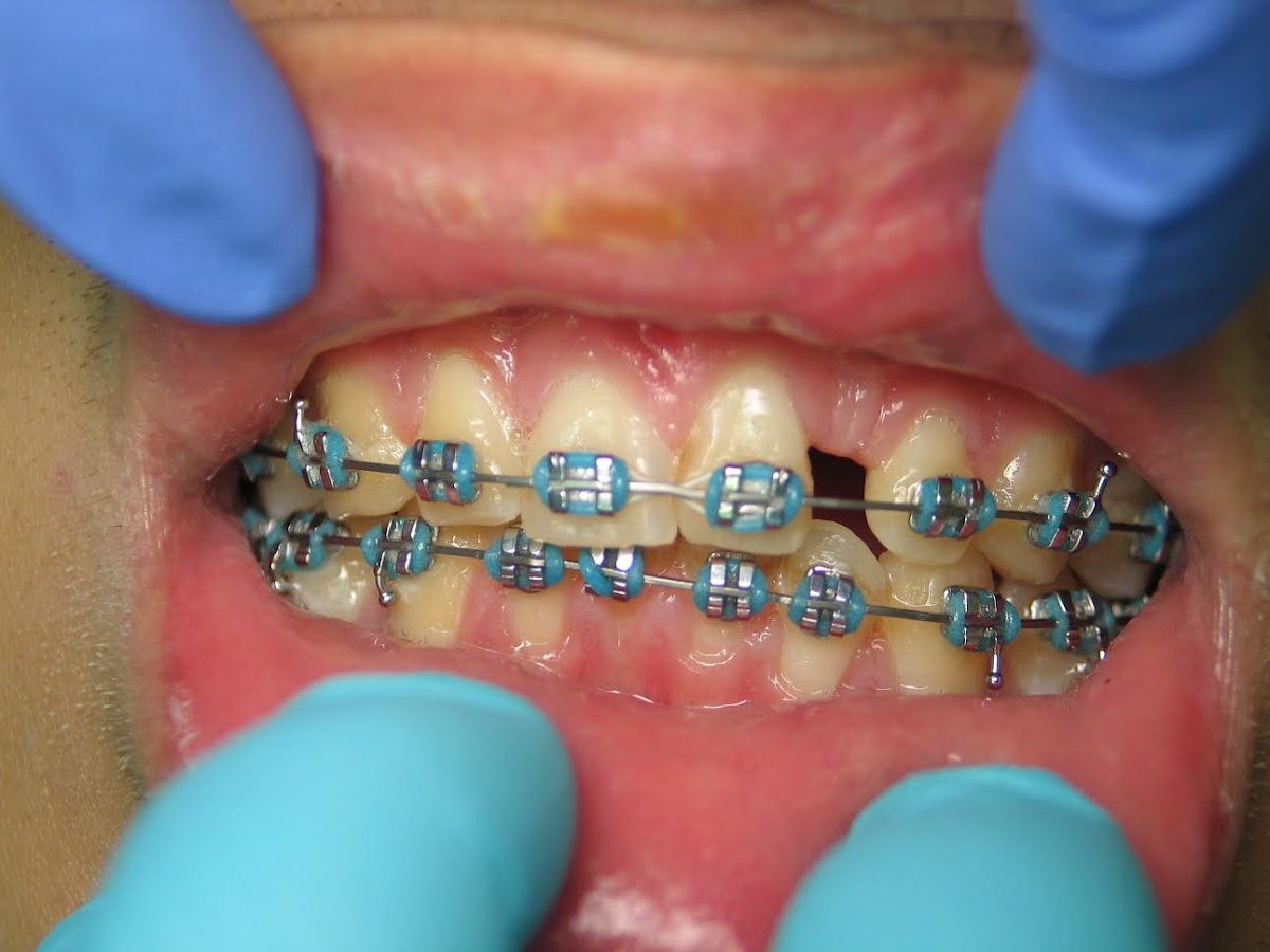 Albert M. Tsang Dds - Pinole General And Implant Dentistry photo 6