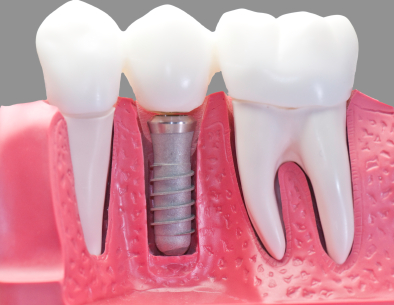Optimum Oral Surgery & Dental Implants photo 4
