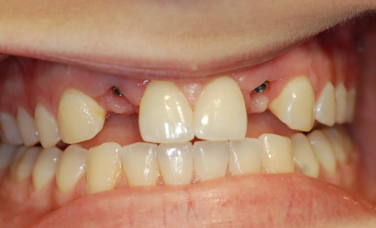 Wickham Dental Care photo 6