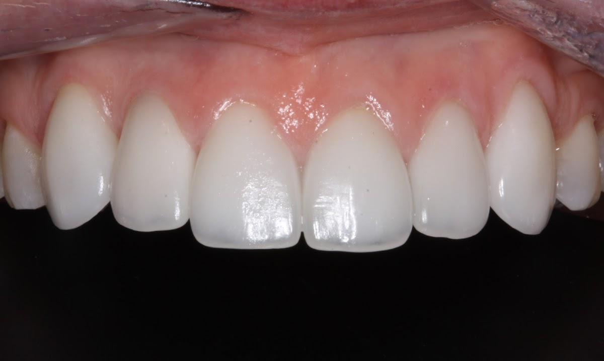 Three Two Three Dentistry photo 5