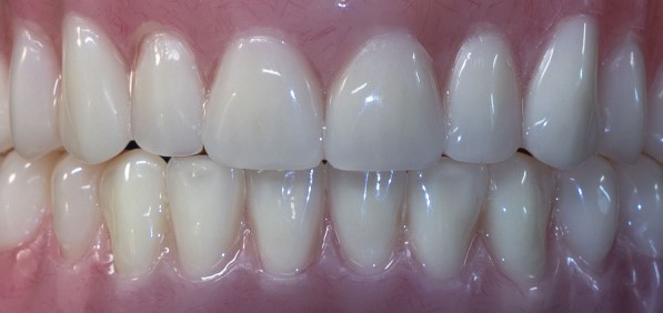 Smile Prosthetics photo 3