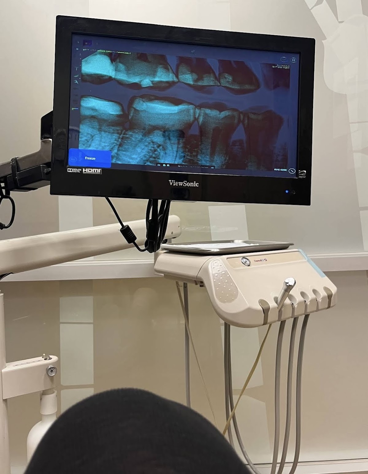 Aspen Dental - College Station photo 3