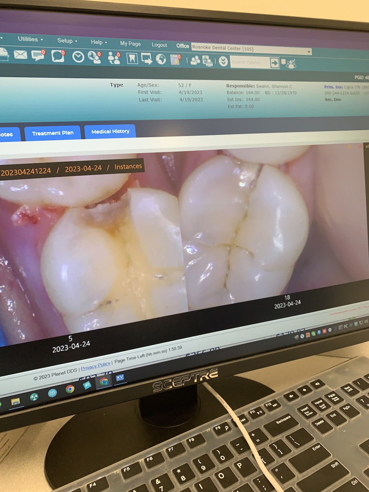 Roanoke Dental Center - Electric Rd photo 4