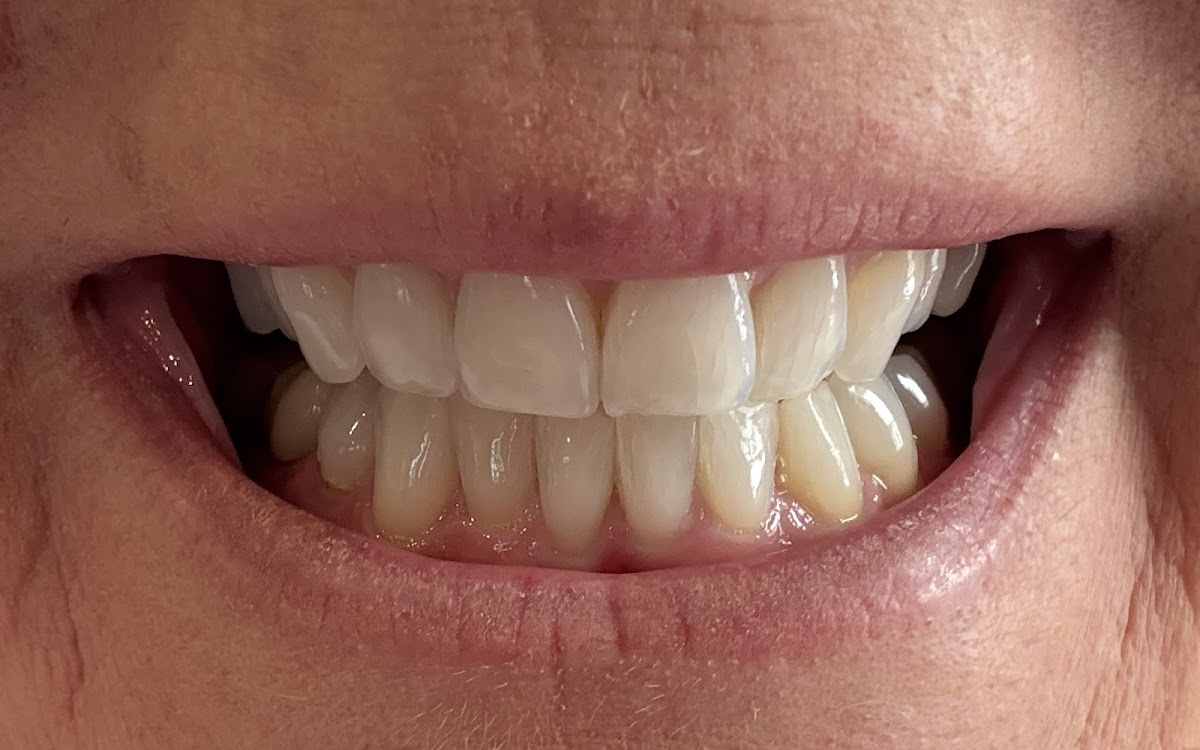 Dr. Spencer Zaugg, Family & Implant Dentistry photo 3