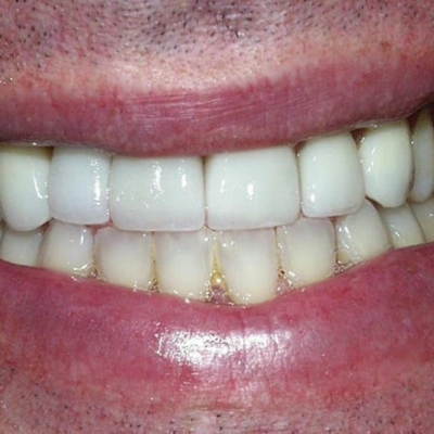 Barton Oaks Dental Group photo 6