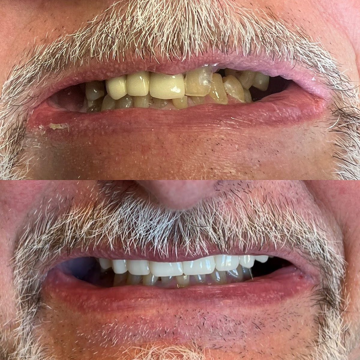 405 Implants & Dentures, Dr. Austin Brasher & Dr. Christian Contreras photo 2