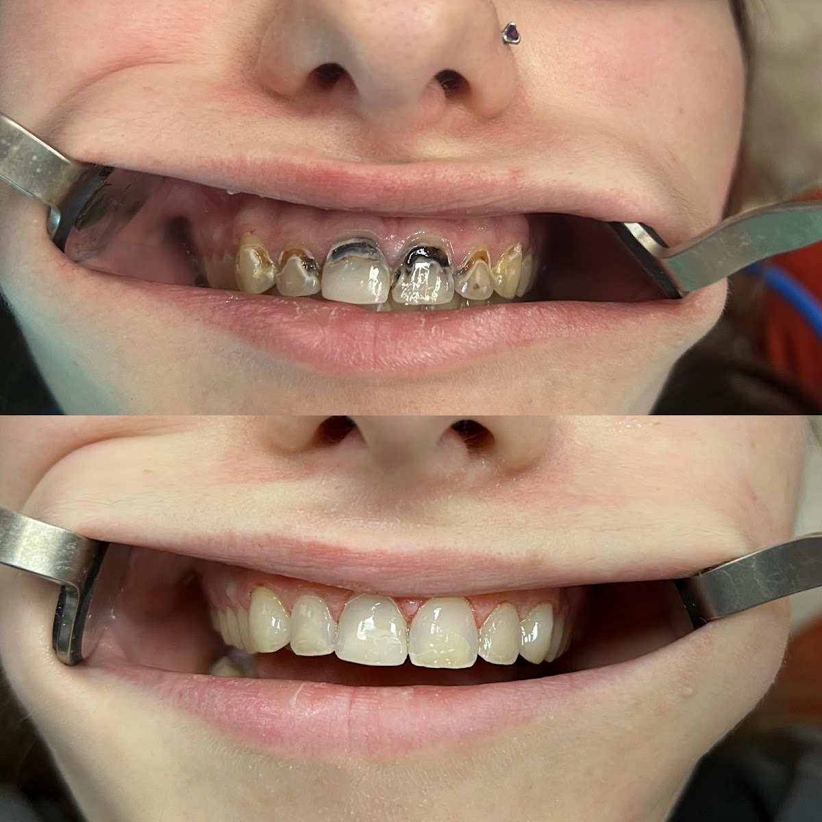 405 Implants & Dentures, Dr. Austin Brasher & Dr. Christian Contreras photo 5