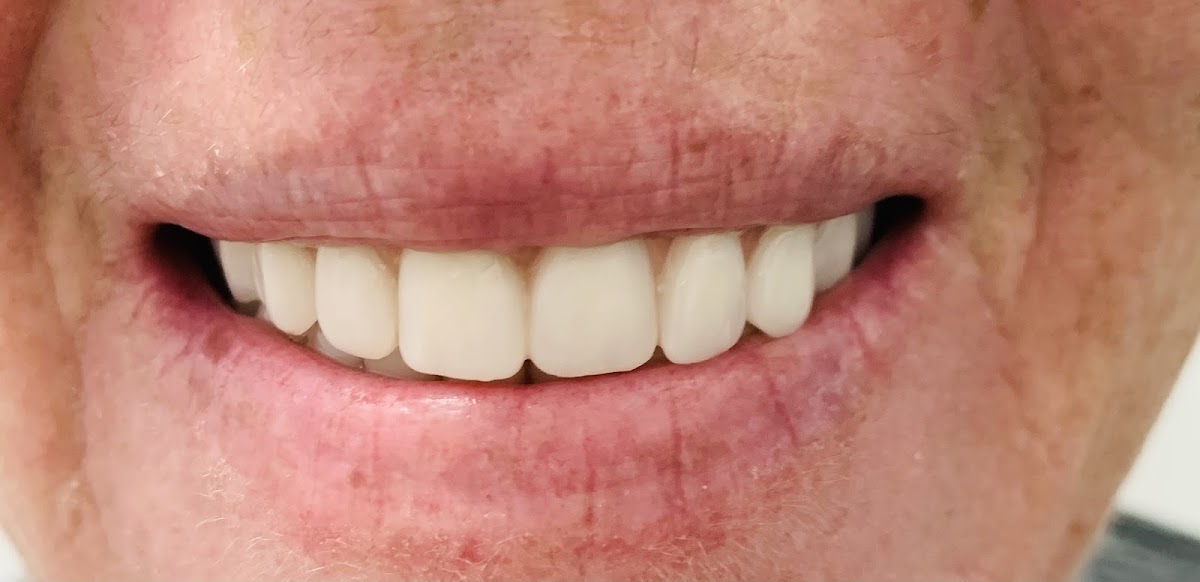 Austin 3d Dental photo 4