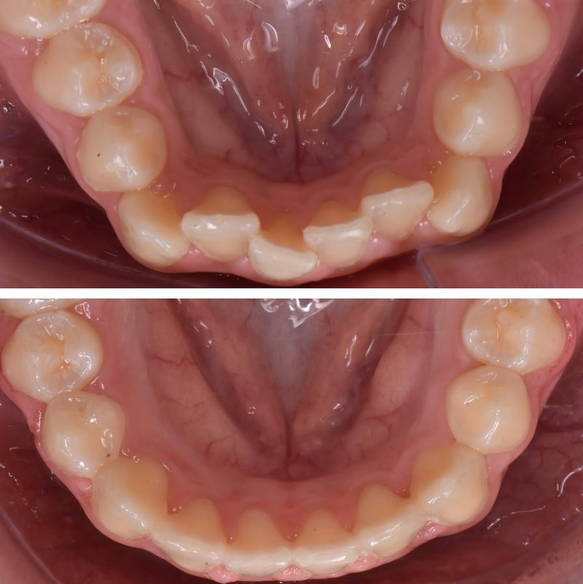 Elite Dental Implants and Orthodontics - Pleasanton photo 5