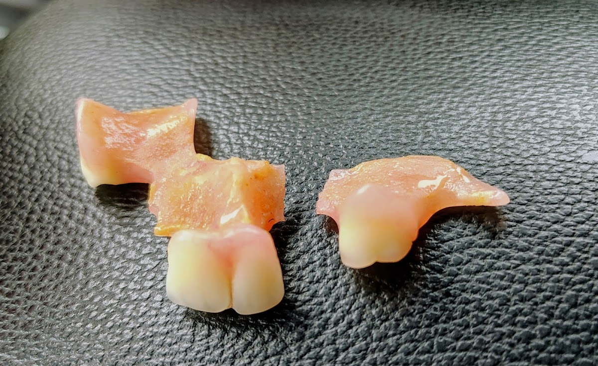 Aspen Dental - Casa Grande photo 1