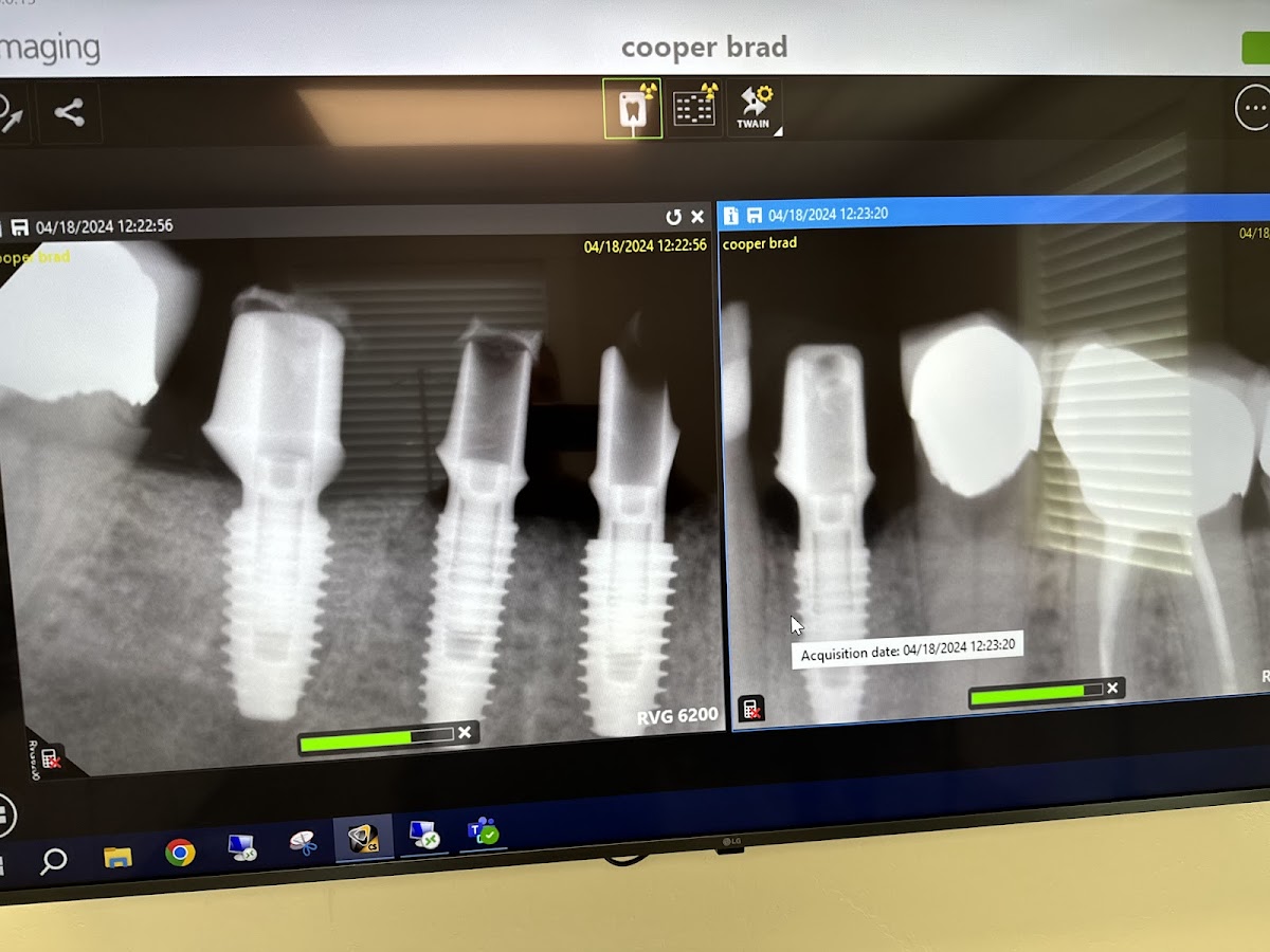 Clark Oral & Facial Surgery - Twin Falls photo 4