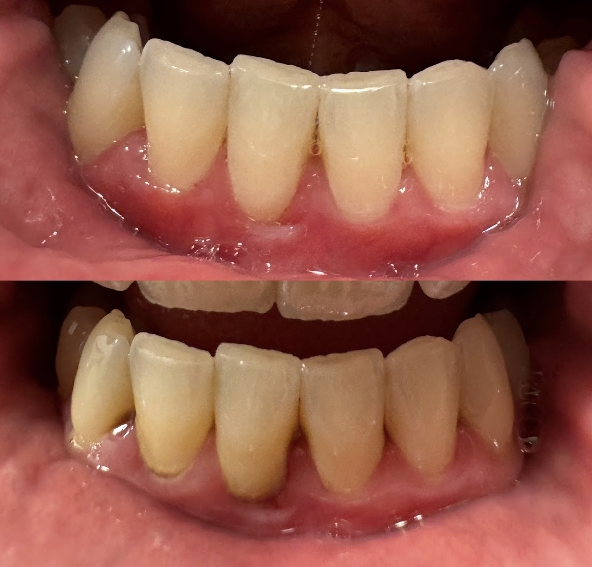 Ankeny Aesthetic Dentistry photo 5