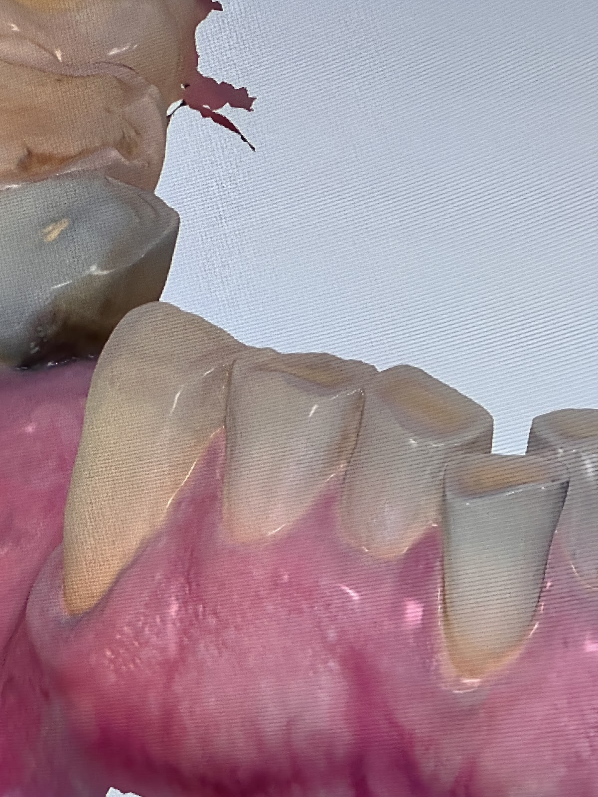 Aspen Dental - Bridgewater photo 1