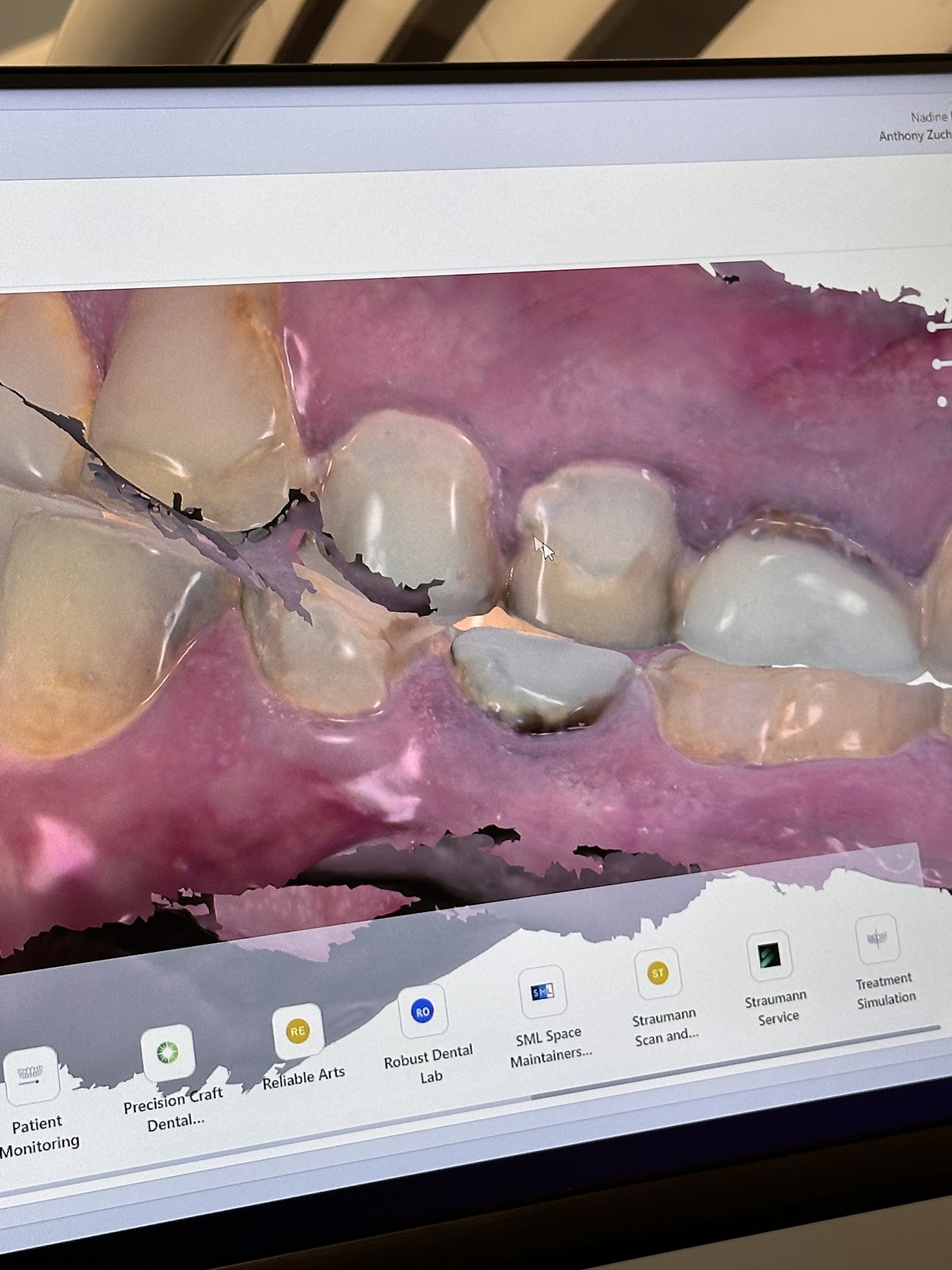 Aspen Dental - Bridgewater photo 2