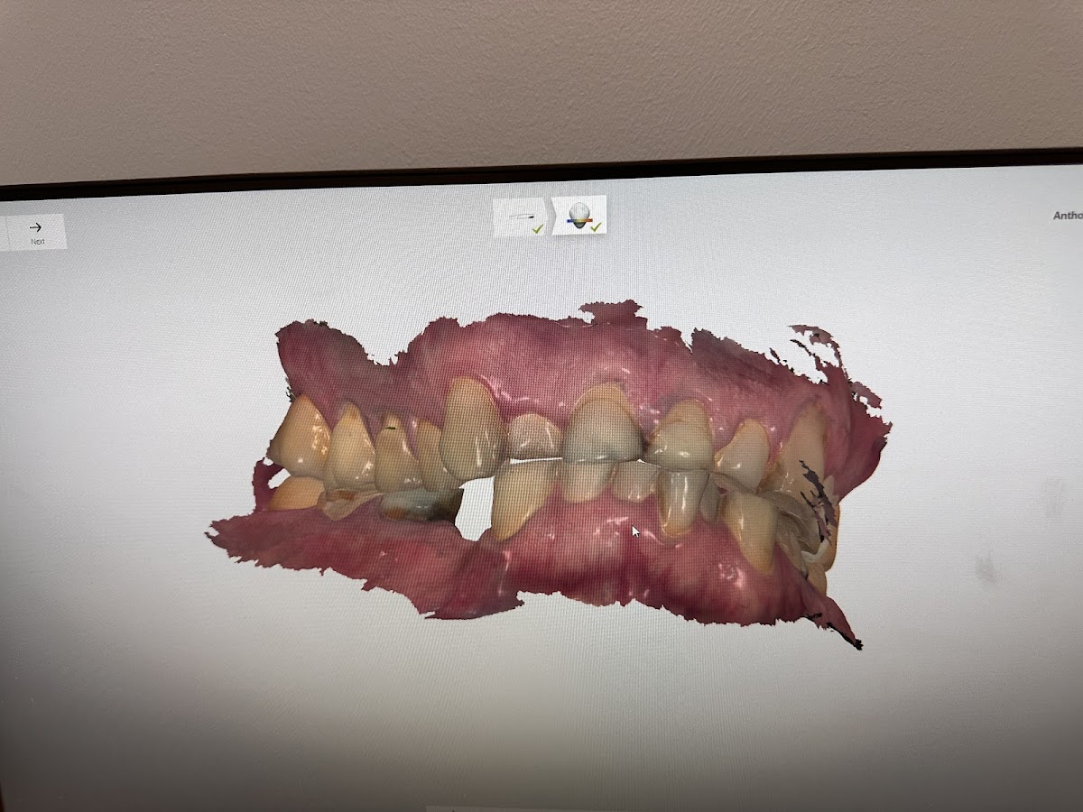 Aspen Dental - Bridgewater photo 3