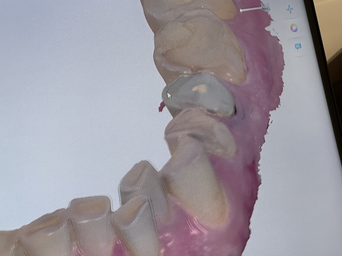 Aspen Dental - Bridgewater photo 5