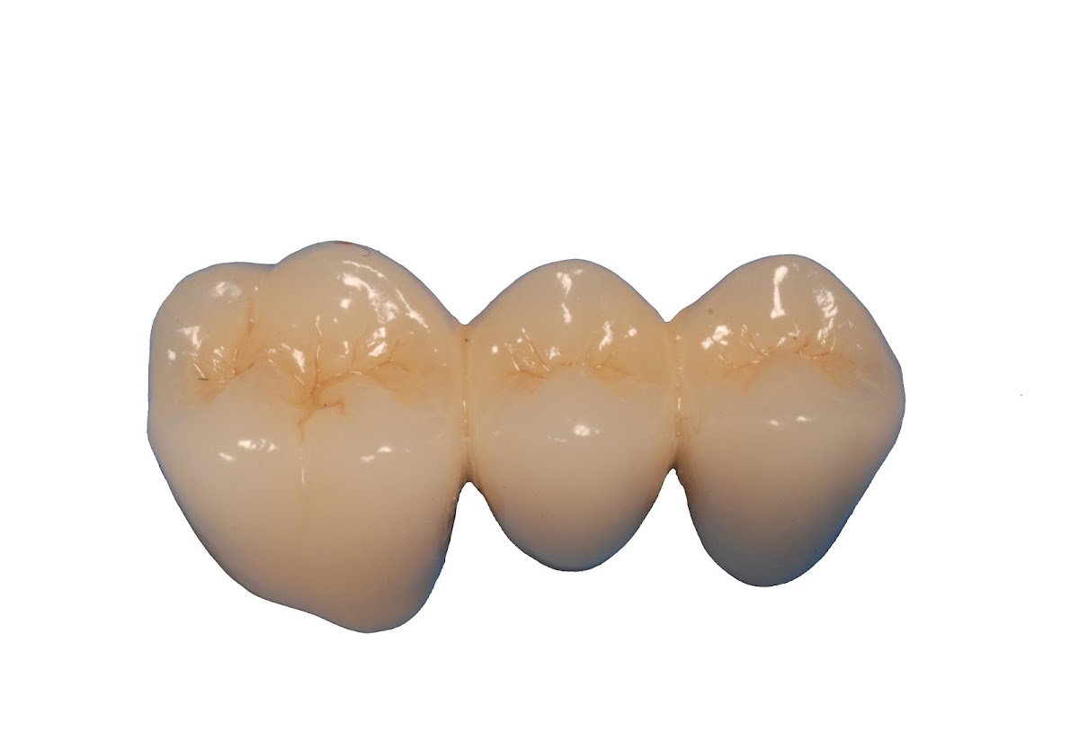 Gcdl/golden Ceramic Dental Lab photo 1