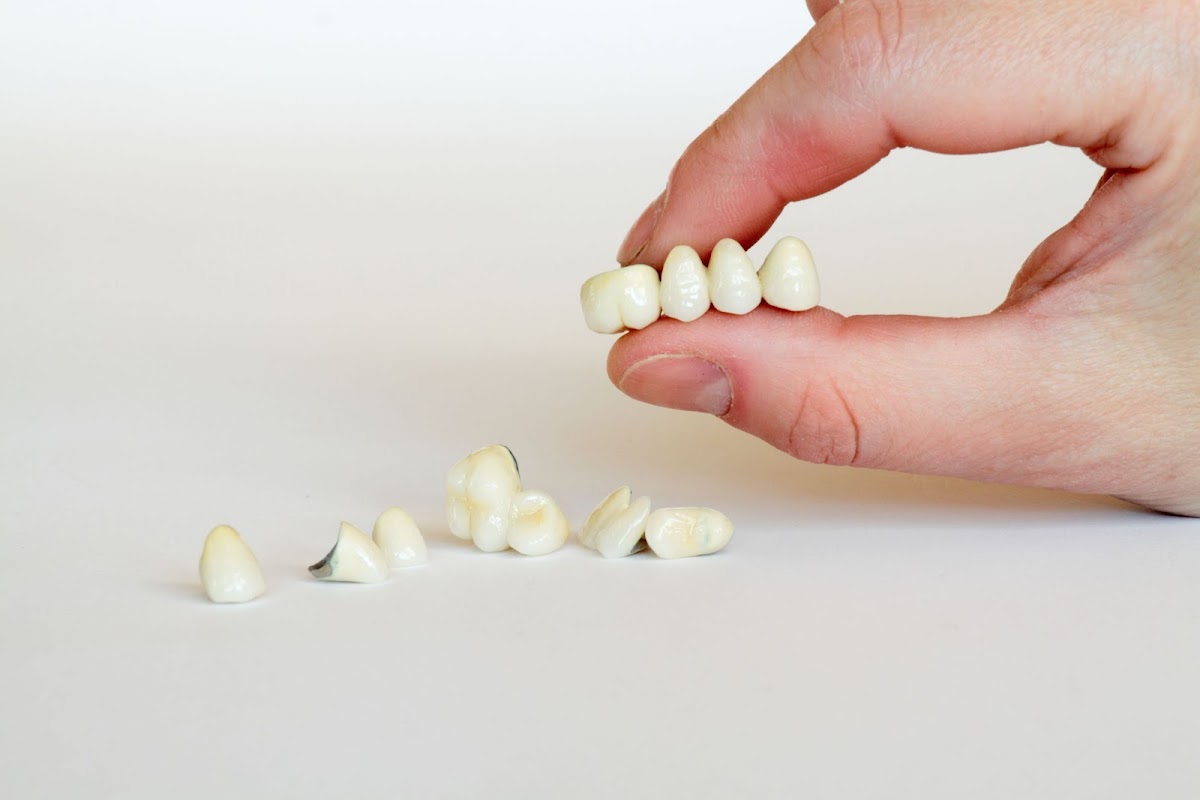 Gcdl/golden Ceramic Dental Lab photo 2