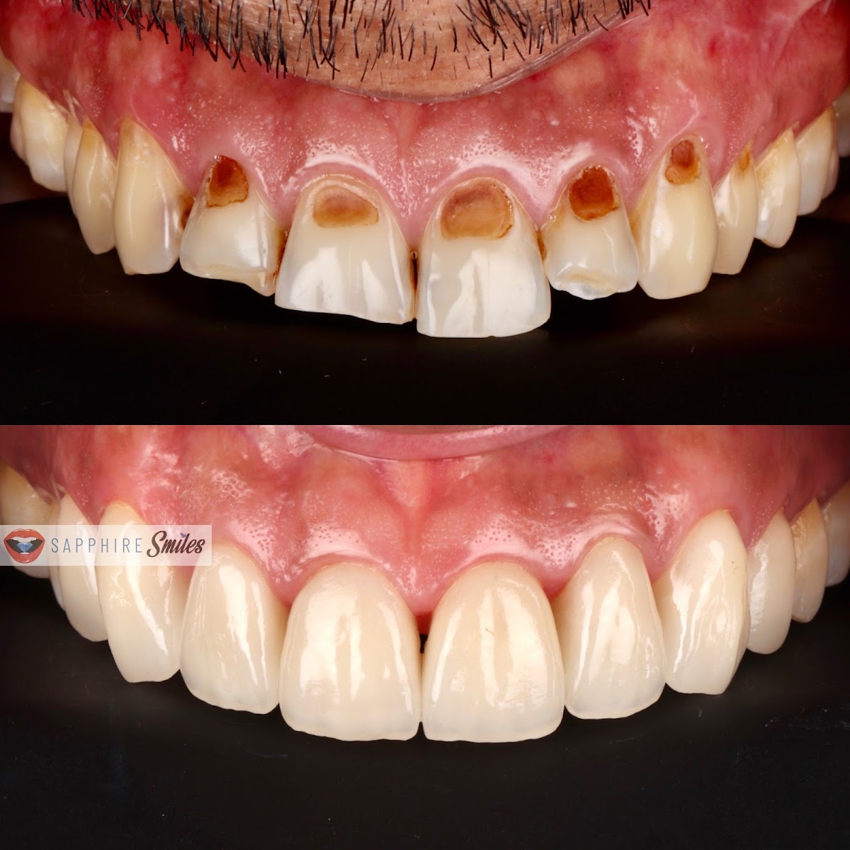 Gcdl/golden Ceramic Dental Lab photo 5