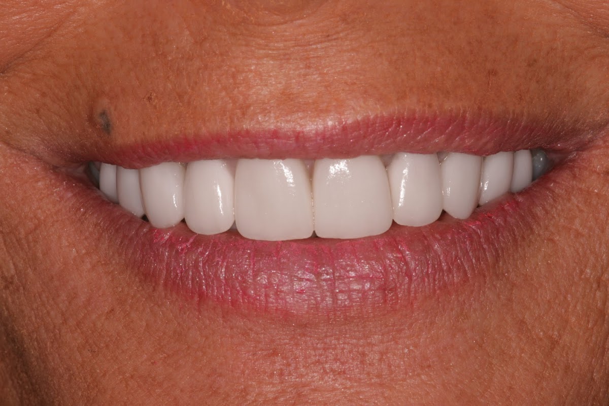 Southington Dentistry photo 4