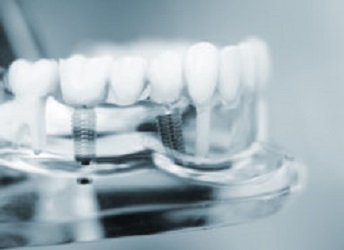 Catherine A. Bishop, DDS, Periodontist & Dental Implants photo 5