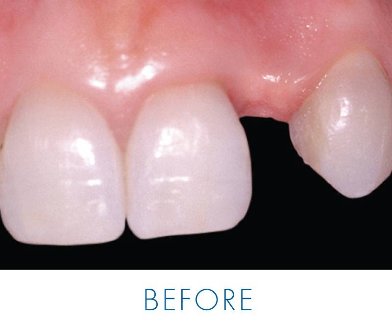 Implant Dentistry Centre photo 4