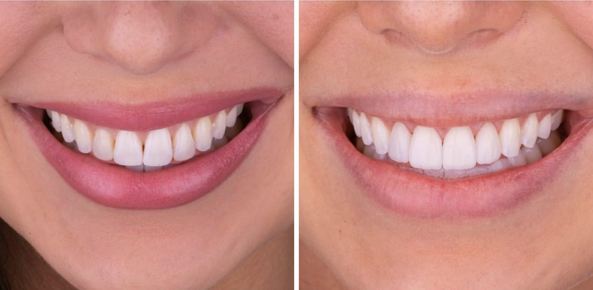 Ingenic Dental Studio photo 3
