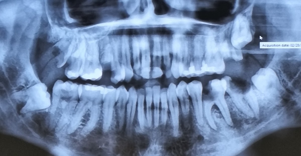Aspen Dental - Loganville photo 4