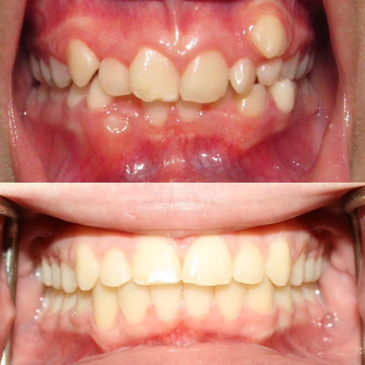 Upland Dental Implant And Orthodontics photo 2