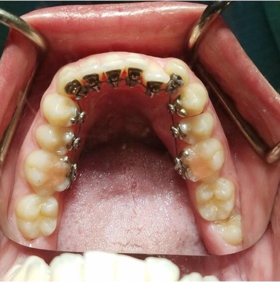 Upland Dental Implant And Orthodontics photo 3