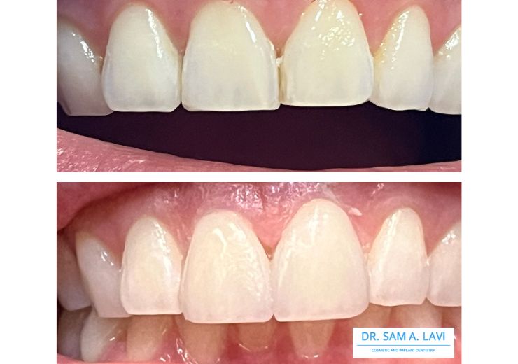 Dr. Sam Lavi Cosmetic and Implant Dentistry photo 2