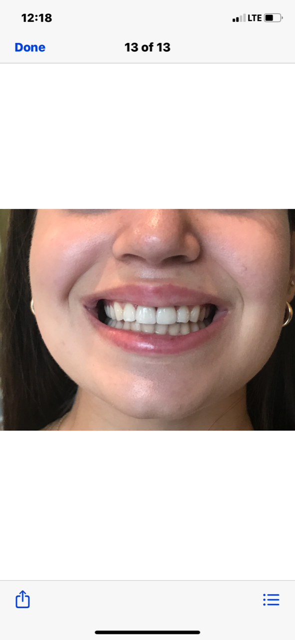 Dr. Sam Lavi Cosmetic and Implant Dentistry photo 5