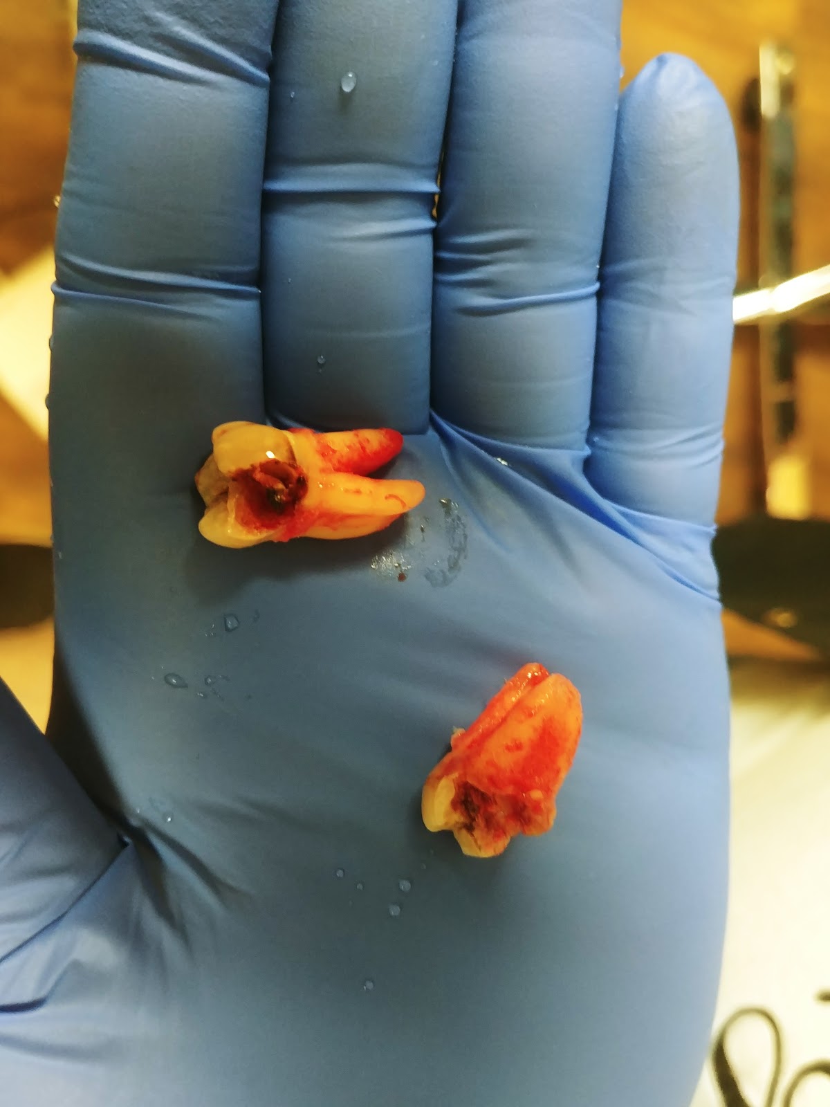 Oral Surgery Kansas photo 2