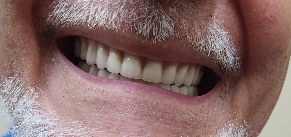 Affordable Dentures & Implants - East Orlando photo 5