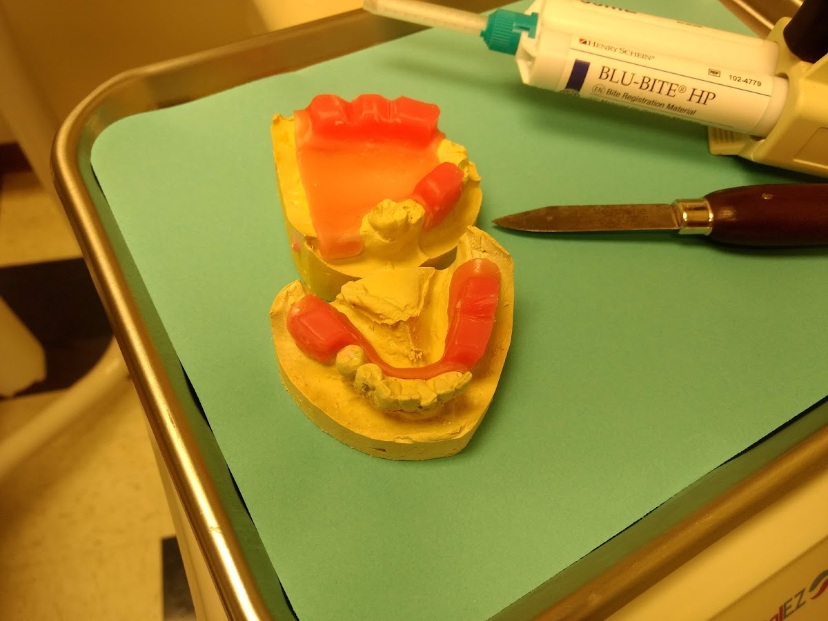 Aspen Dental - Knoxville photo 4