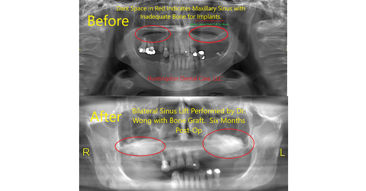 Huntingdon Dental Care, LLC photo 5