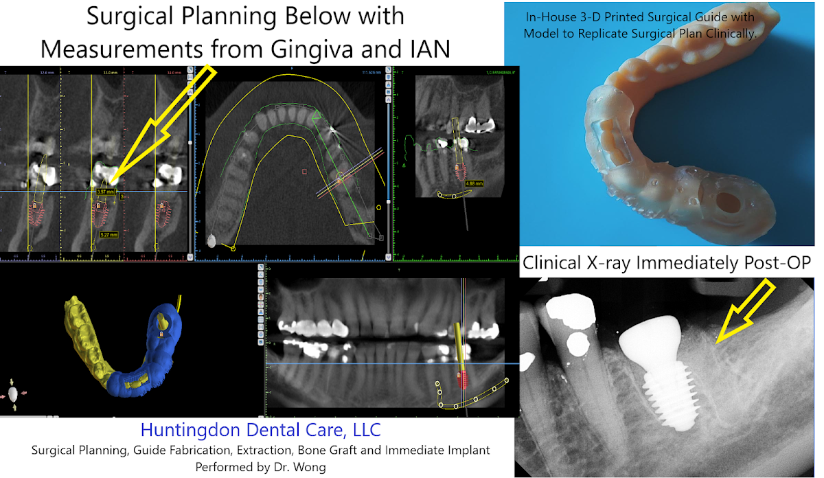 Huntingdon Dental Care, LLC photo 6
