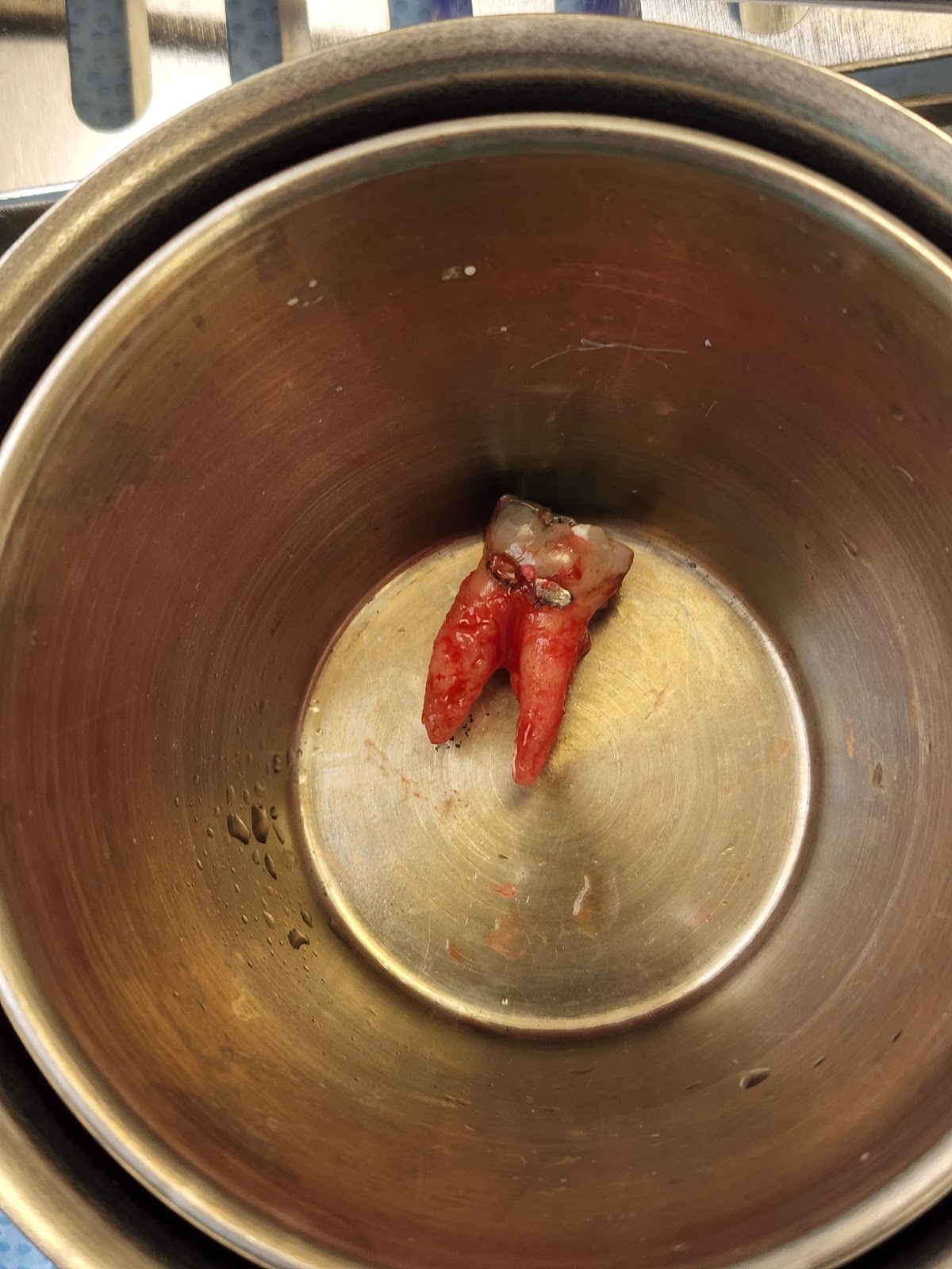 Upper Valley Oral Surgery photo 2