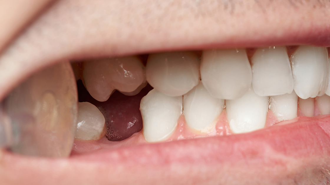 Braasch Oral Surgery photo 4