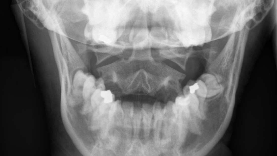 Braasch Oral Surgery photo 5