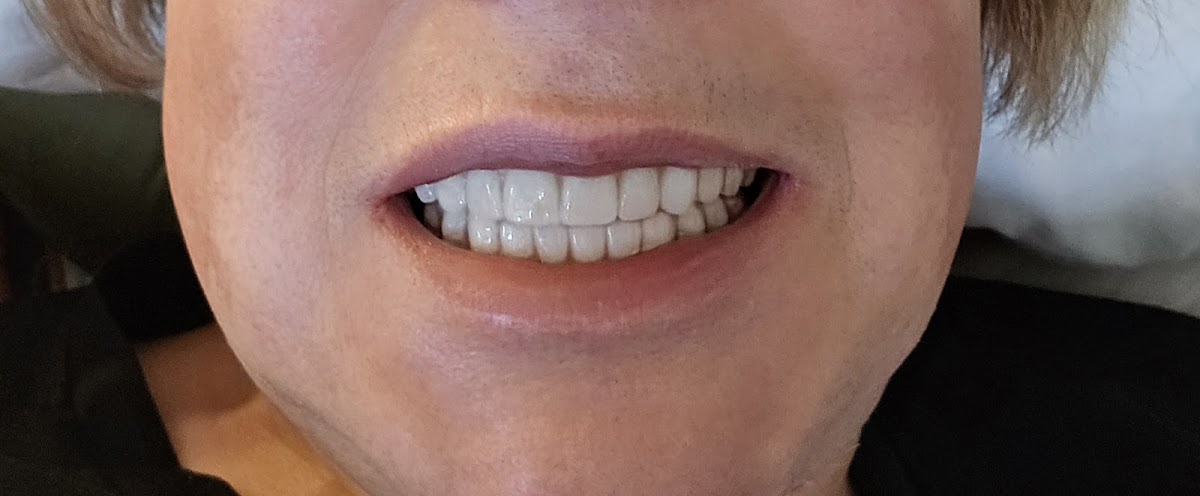 Reno Dentures And Implants photo 4