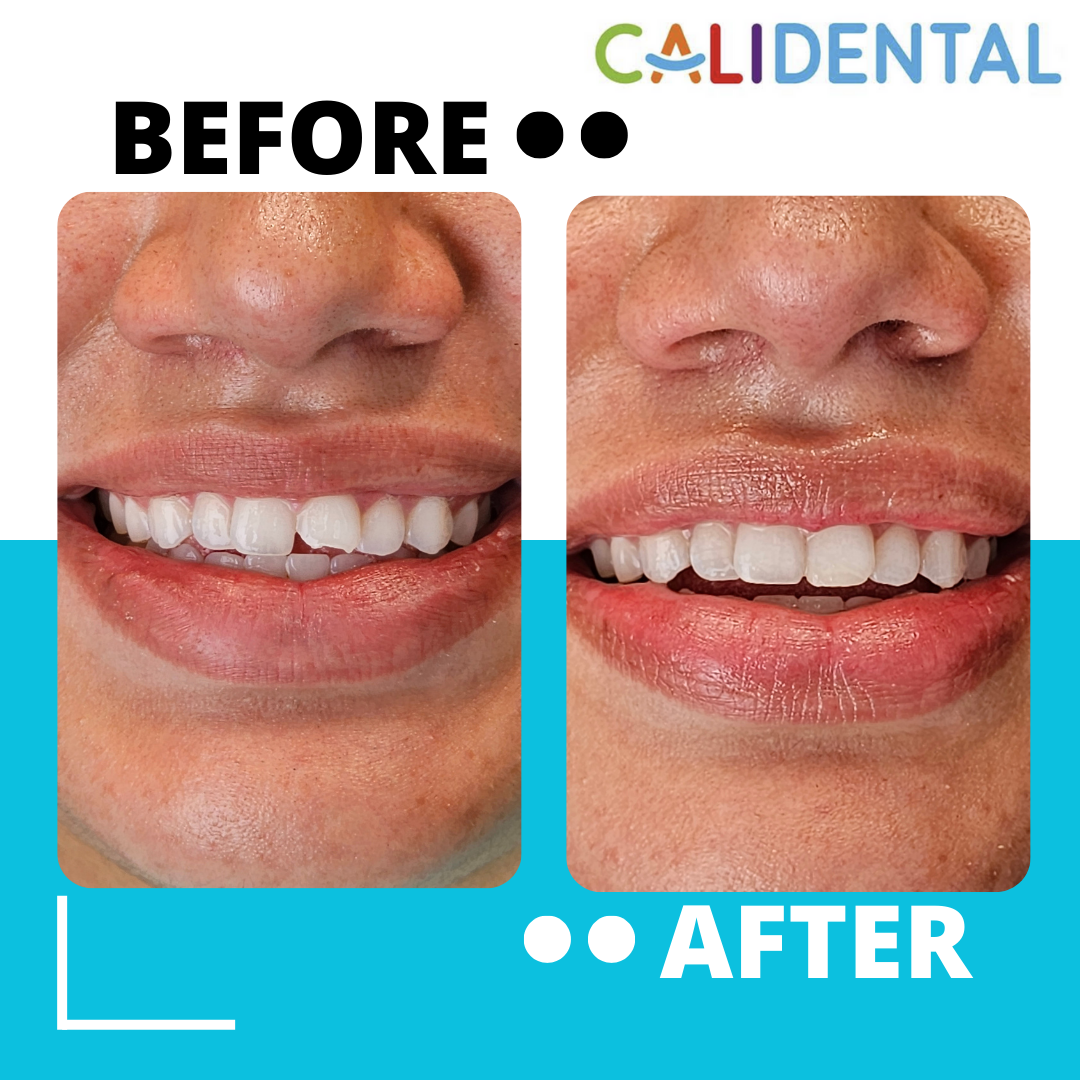Calidental Paso Robles photo 2