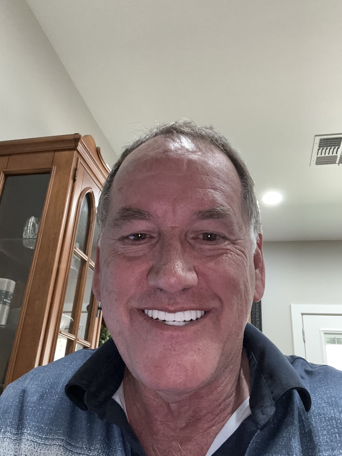 Smile Clinic Arizona Dental Implant Center photo 6
