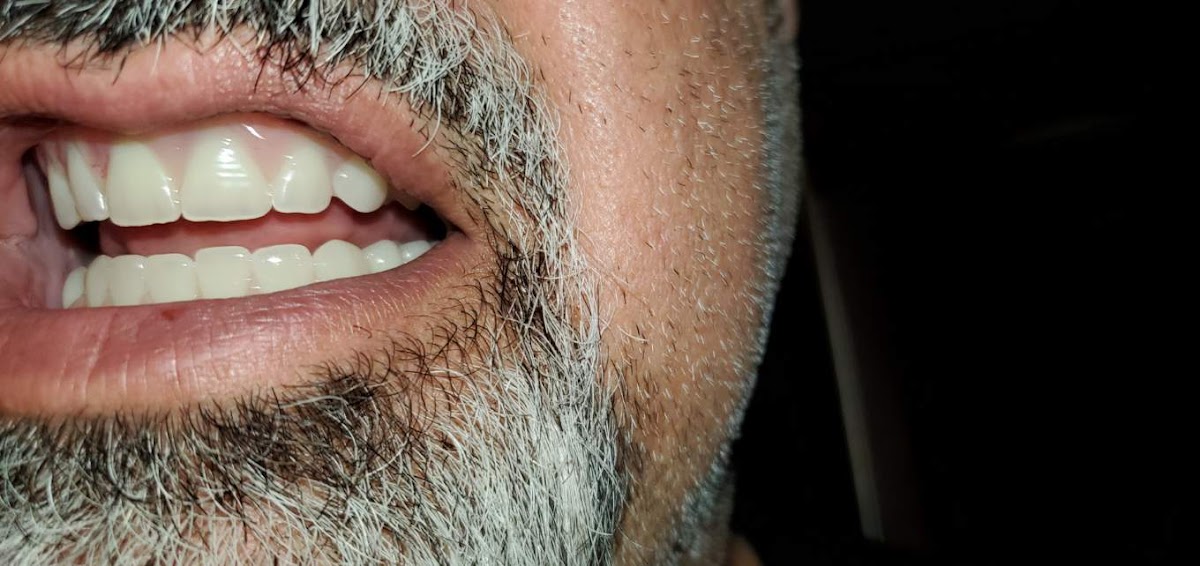 Aspen Dental - Englewood photo 5