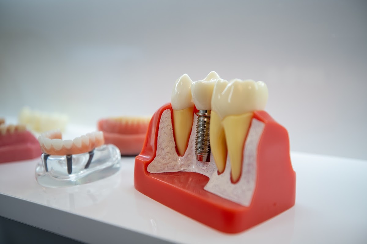 Synergy Dental Implant & Oral Surgery Center photo 5