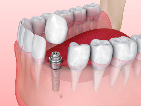 Reichel Dental photo 4