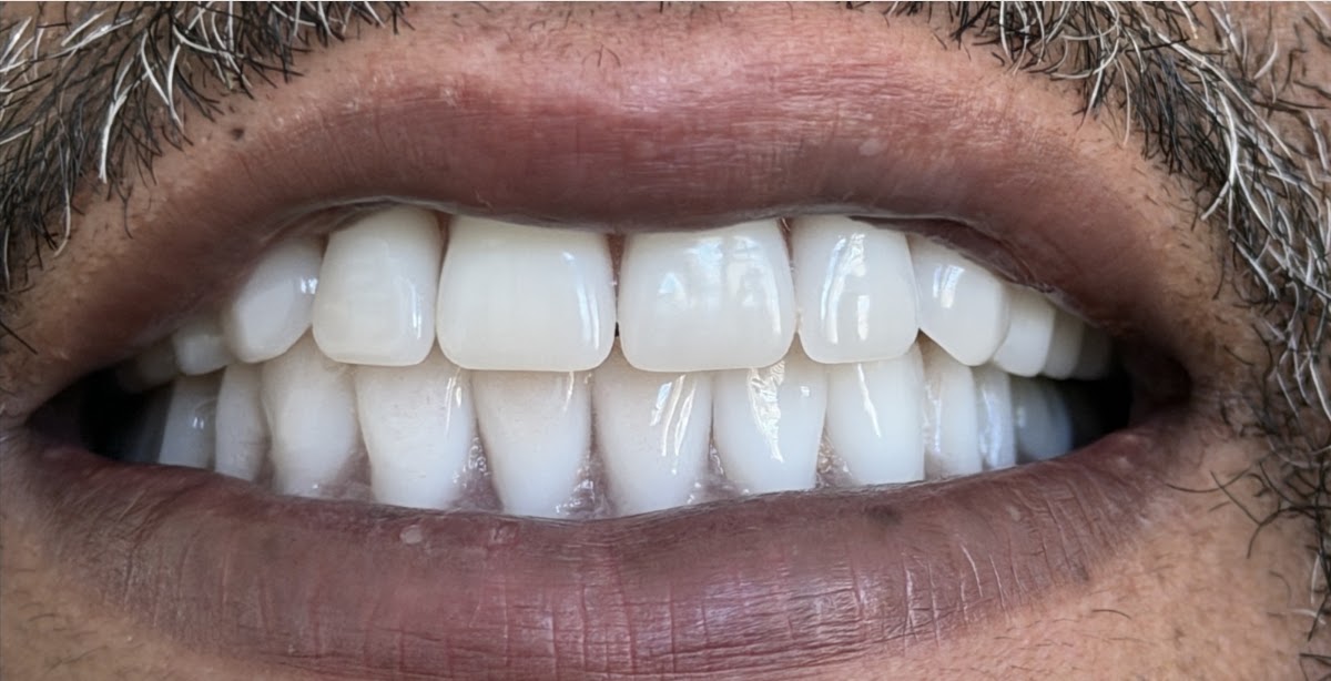 Affordable Dentures & Implants - North Jacksonville photo 2