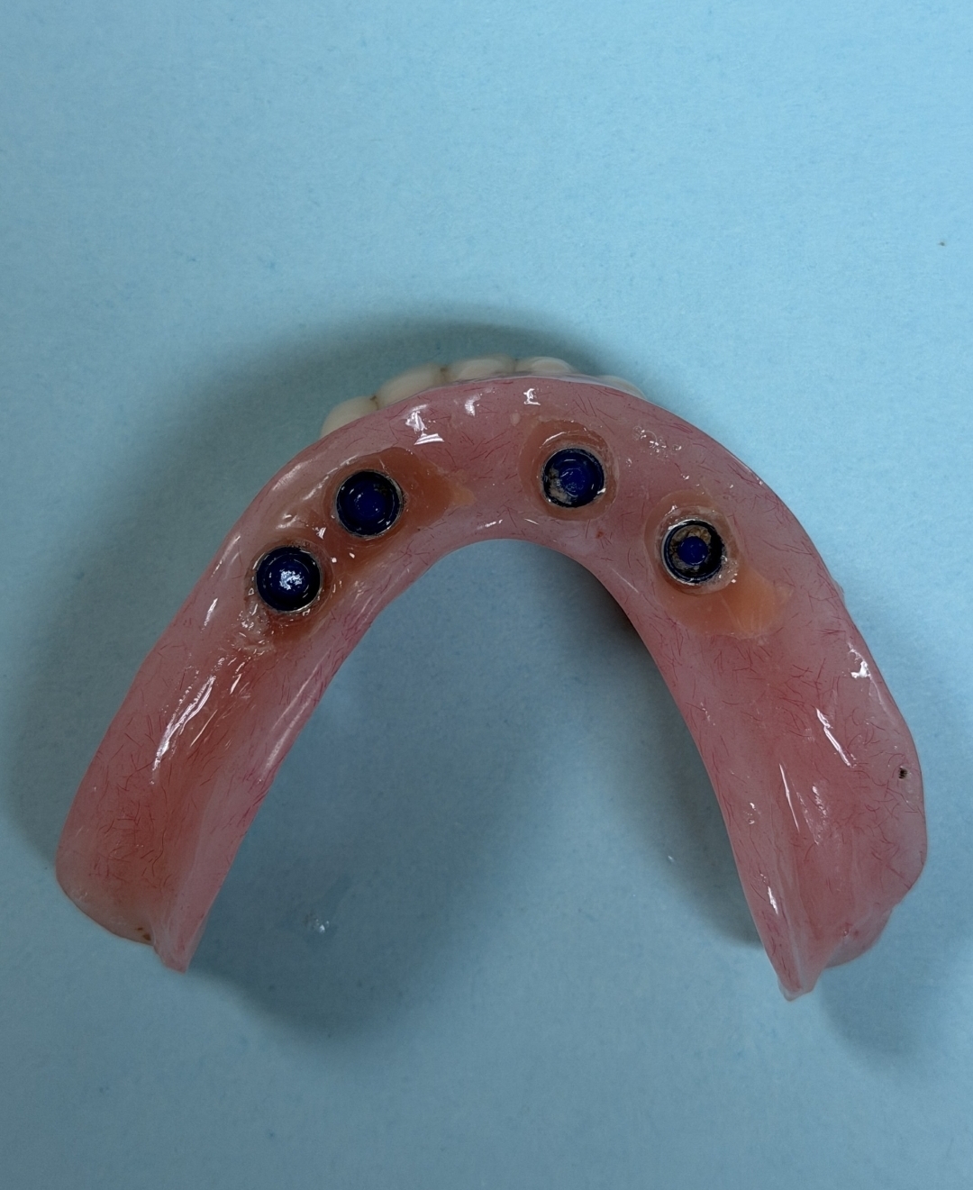 Affordable Dentures & Implants - North Jacksonville photo 3