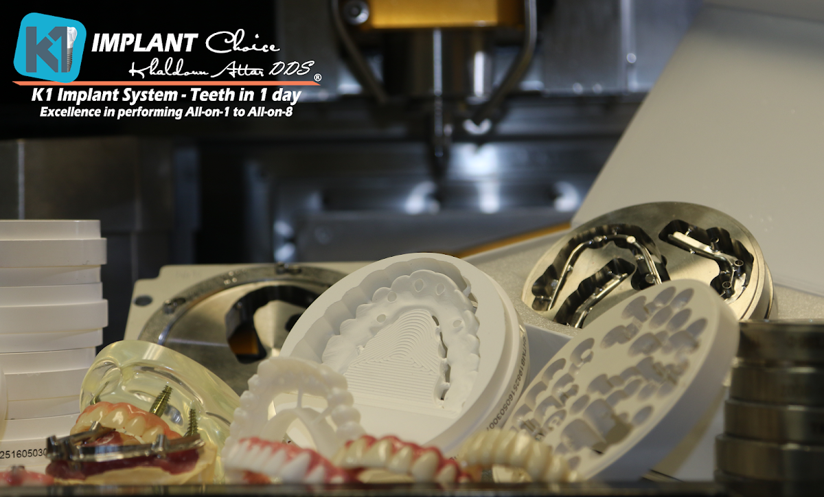 K1 Implant Choice photo 1