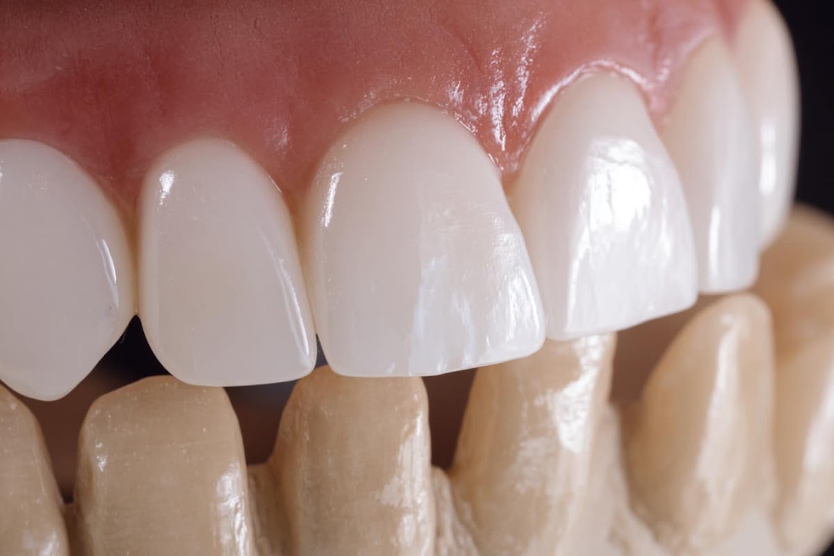 Care Dental Implant & Cosmetic Center photo 2